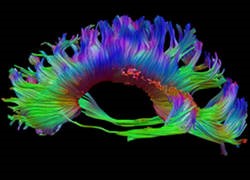 UVMMC GME Diagnostic Radiology Research photo