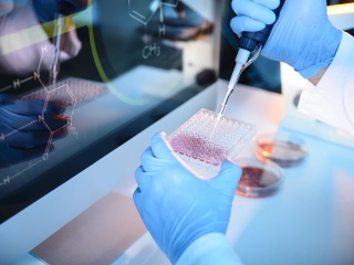 A technicians gloved hands work with blood samples in a laboratory.