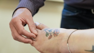 A medical professional does acupuncture on a patient's foot.