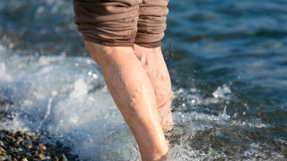 Man with varicose veins in his legs splashes in the water.